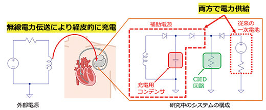CIED をワイヤレスで充電する新システムの模式図