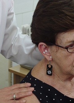 痛みを和らげるための耳鍼療法